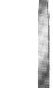 Jackson Tracheal Hook 5 1/4″ sharp