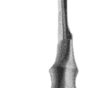 Richardson Retractor 9 1/2″ 1 1/2″ x 1 1/2″ grip handle
