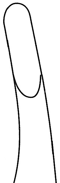 Ruskin Rongeur 6″ curved 4mm, double action - Image 2