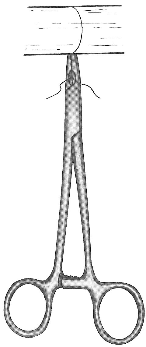 Wire Twister and Tightener 6 1/4″ side fenestration